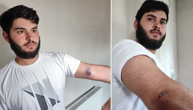 Bahçeye Kaçan Top, Mahallelileri Sokağa Dökerek Cezalı Conoları Ortaya Çıkardı