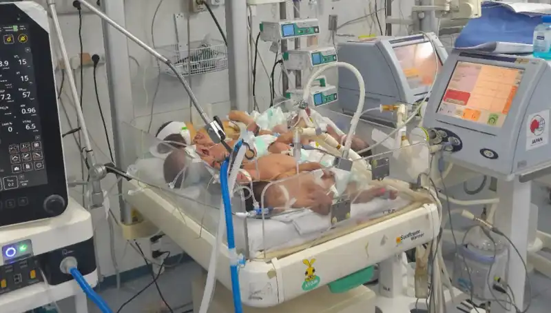 Gazzeli Doktorlar Çaresizlik İçinde: Aynı Kuvözdeki Çoklu Bebekler Krizi