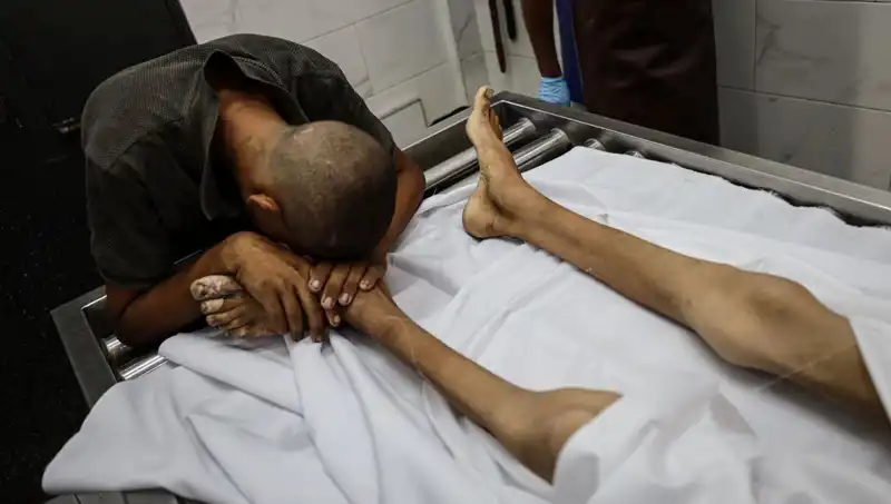 Gazze'de Açlık Felaketi: Bir Çocuk Daha Hayata Veda Etti